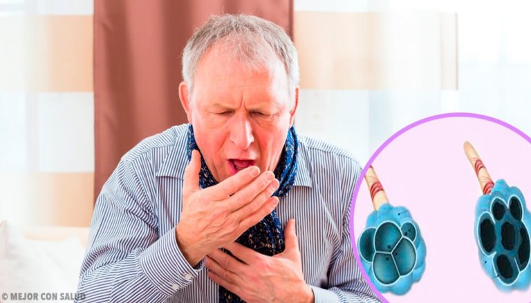 Malattia polmonare ostruttiva cronica (COPD)