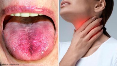 Placche in gola: 6 modi per riconoscerle