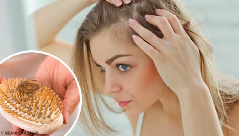 Capelli in caduta libera: quali sono le cause?