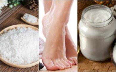 Ammorbidire i calli con 5 rimedi naturali