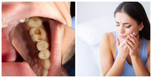 Infezione dentale: 7 sintomi