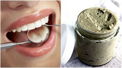 Curare le carie con un rimedio 100% naturale