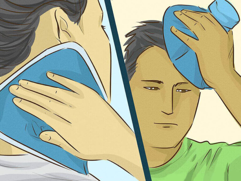 Rimedi naturali per la cefalea