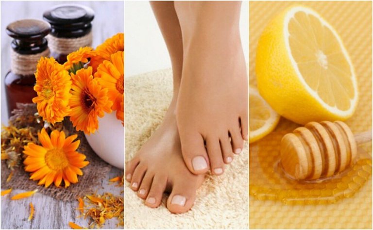 Unghie incarnite: 5 rimedi naturali