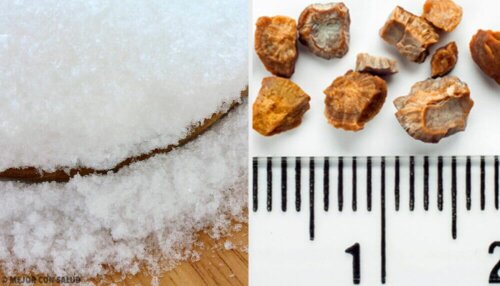 7 rimedi casalinghi per espellere i calcoli renali