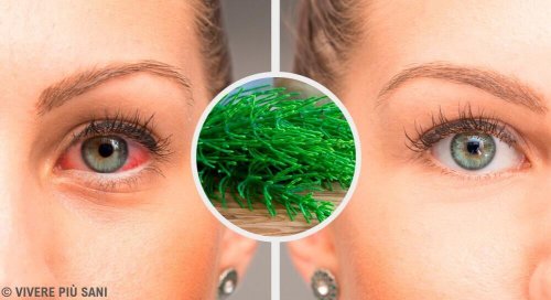 Congiuntivite: 7 consigli per eliminarla in modo naturale