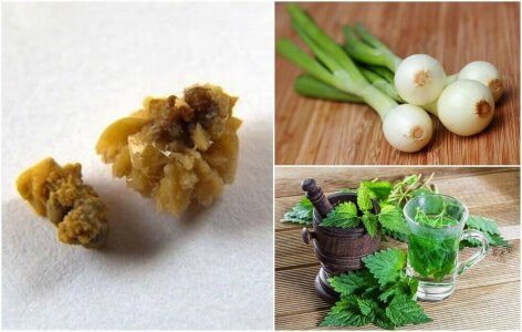 Combattere i calcoli di acido urico con 5 rimedi naturali