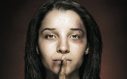 Donna con cicatrici che fa segno di stare in silenzio