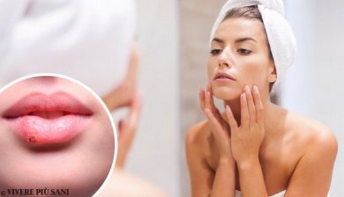 13 segnali sul nostro viso che rivelano la presenza di malattie