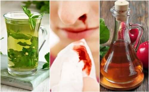 Sangue dal naso: 5 rimedi naturali