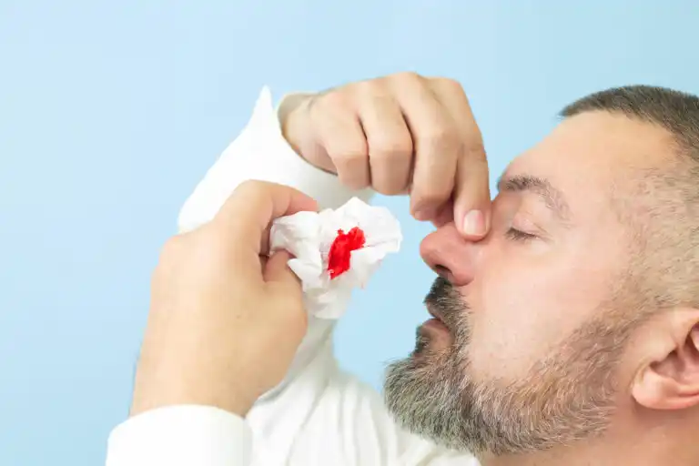 Sangue dal naso: 6 rimedi naturali