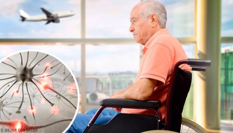 Malattia di Huntington