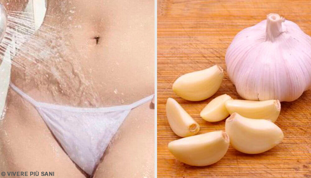 Micosi vaginale: 3 rimedi a base d’aglio Micosi vaginale: 3 rimedi a base d’aglio