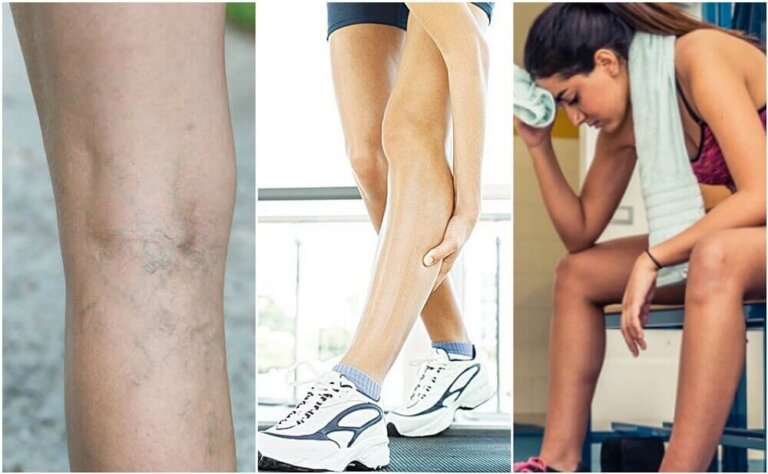 Crampi muscolari: possibili cause