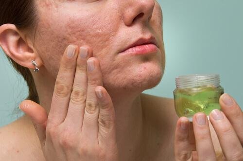 Aloe vera per la cura della pelle