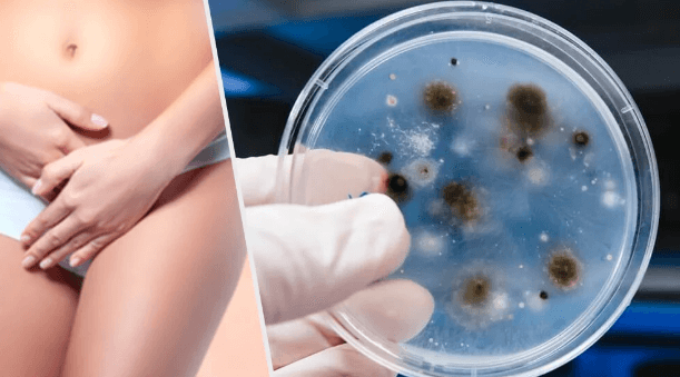Infezioni vaginali: tipologie e cause Infezioni vaginali: tipologie e cause