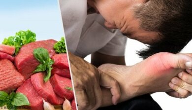 Alti livelli di acido urico: cause principali