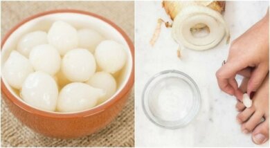 Calli ai piedi: rimedio 100% naturale