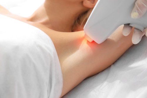 Miti e verità sulla depilazione laser