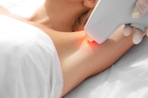 Miti e verità sulla depilazione laser