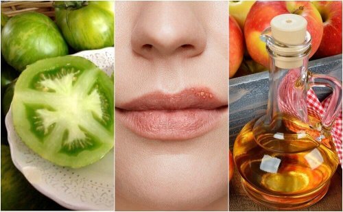 Combattere l'herpes labiale con 5 trattamenti naturali