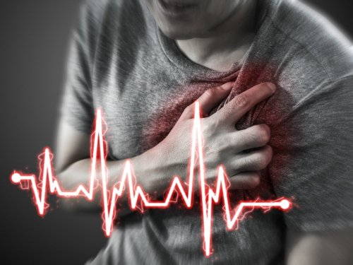 Infarto acuto del miocardio