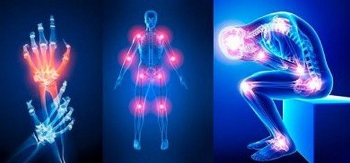 Integratori per le articolazioni: consumo e benefici