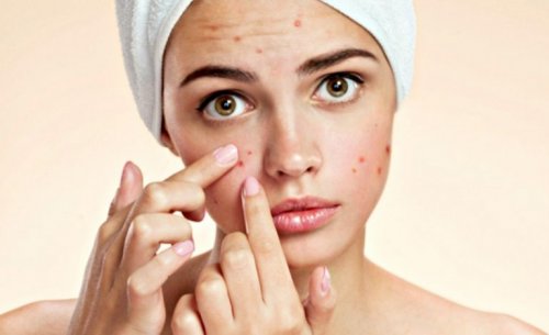Ragazza con acne
