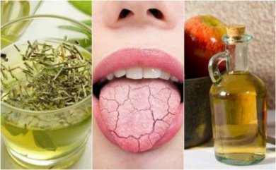 Secchezza delle fauci: 5 rimedi naturali