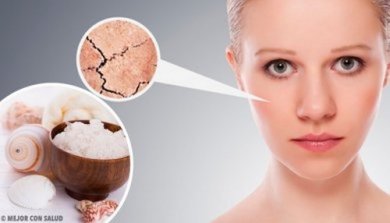 5 rimedi naturali per la pelle secca