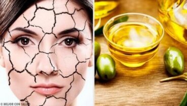 Secchezza cutanea: i trattamenti naturali più indicati