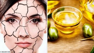 Secchezza cutanea: i trattamenti naturali più indicati