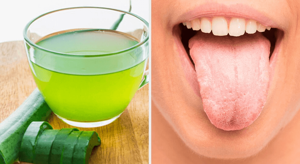 Lingua bianca: 7 rimedi naturali Lingua bianca: 7 rimedi naturali