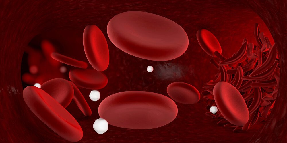 Rimedi infallibili per combattere l’anemia in casa