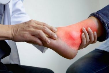 Rimedi naturali per le infiammazioni