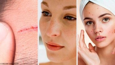 Problemi frequenti del viso: 4 trattamenti