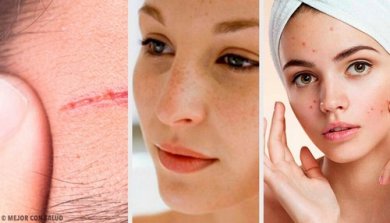 Problemi frequenti del viso: 4 trattamenti