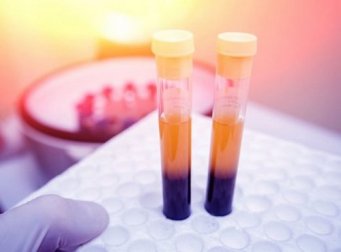 Piastrine basse: 5 rimedi per aumentare il loro livello