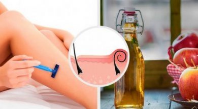 Rimedi naturali per trattare la pseudofollicolite