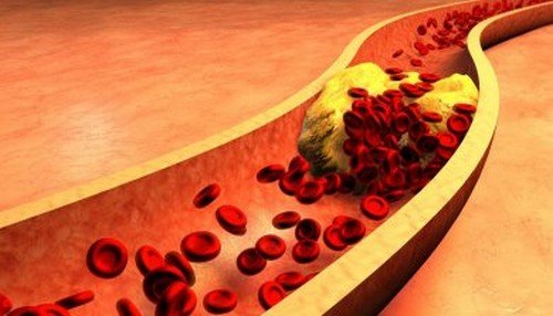 Acqua di scagliola e cannella per pulire le arterie