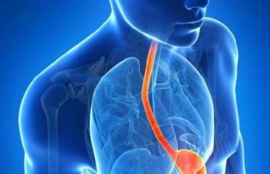 Il reflusso gastrico e alcuni consigli per alleviarlo