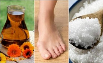 Rimedi naturali per l'alluce valgo: 4 efficaci soluzioni