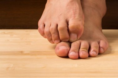Rimedi contro i funghi a base di ingredienti naturali