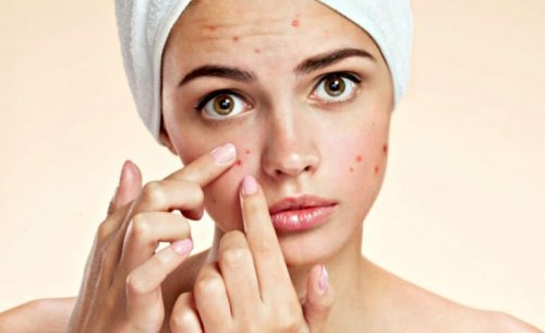 Viso con acne