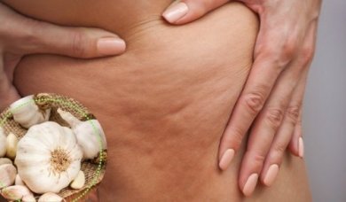 Cellulite: 5 alternative per combatterla