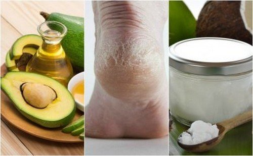 Creme naturali per i talloni