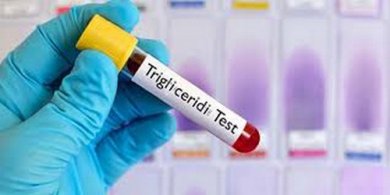 Abbassare i trigliceridi: dieta settimanale