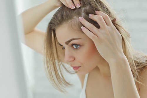 Dolore Al Cuoio Capelluto 6 Possibili Cause Vivere Piu Sani