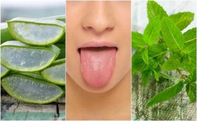 Afte sulla lingua: alleviarle con rimedi naturali
