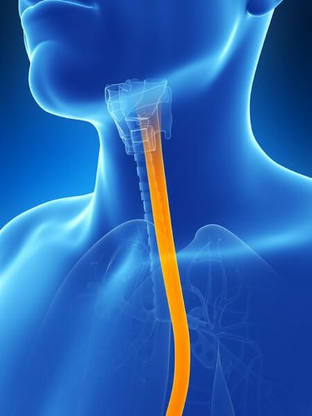 Alleviare i sintomi dell’esofagite con rimedi naturali